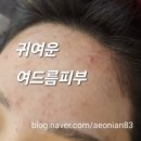 에스엔투