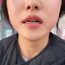 압구정사랑이아프니구강악안면외과치과의원 이미지