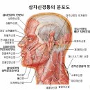 설인신경통과 삼차신경통의 합병증 및 치주염과 설염과의 관계. 이미지