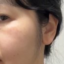 좋은약국 | 피코토닝 피부장벽 케어에 좋은 EGF재생크림 약국화장품 지피덤 후기