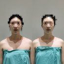 장유프라자 | 김해 신부관리 얼굴경락 고운빛깔에스테틱 김해장유점 솔직후기