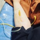 웅상이내과의원 | 화이자 2차주사 후기