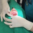 청라365클리어 치과의원 | 금니 크라운 치아색 지르코니아로 일주일만에 교체한 썰_청라365클리어치과