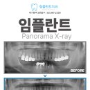 서울유니온치과의원 네이버블로그