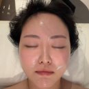 김해피부관리 여드름관리 잘하는 뽀슌에스테틱에서 피부관리 후기