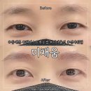 선메디칼(주) | [서울 동대문] 원장님들의 스승님 등장! 흔한 자연눈썹과 차원이 다른 진짜가 나타났다! '미채움...