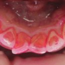 바이오크리닝 이미지