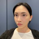강남 신논현 피부과 튠페이스 얼굴지방분해주사 튠팡페이스 리얼 후기