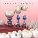 아나플란트치과의원 이미지