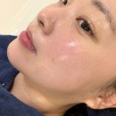 나주 피부관리 전후 비교｜나주 에스테틱 미모오른에서 알테온 관리 받은 후기
