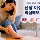 신장에 문제 있을 때 나타나는 몸의 신호 이미지