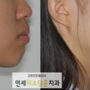 연세미소담은치과 이미지