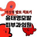 삼성신한내부속의원 | 윤태영모발피부과의원 여성형 탈모 오픈런 후기. 여성형 탈모 치료기 part.1