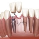 연합치과기공소 이미지