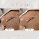 Mollo skin(몰로스킨) | 에스테틱 몰로스킨 순천 조례동 가격위치주소이벤트할인 총정리