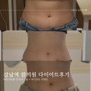 강남 복부다이어트 시술 감량비책 바디라인컨텍터 후기