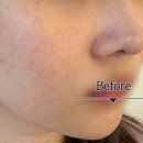 세리영 스킨케어 이미지