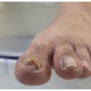 풋솔루션 이미지