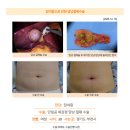 담석증수술후기. 수술 전 제 상태에 대해 친절하고 자세히 설명해주셔서 아픈 환자 입장에선 마음이 놓였습니다. 이미지