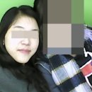 주걱턱 수술한지 어언 10개월이되가네요 이미지