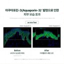 거꾸로 나이 인셀덤