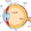 난시 뜻 : 근시난시 차이 이미지