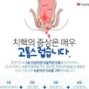 치핵 어떤 들이 나타나는지 알아볼까요 이미지