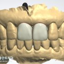 바른이치과기공소 이미지