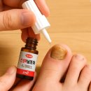 남수원큰사랑약국 | 수원발톱무좀 레이저 치료 실비 병원 추천