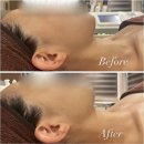 모디페이스 | 광주 매곡동 모공 리프팅 3d 윤곽관리 찐 후기, 미모디에스테틱