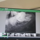 수유 연세고운미소치과 정기검진+교정상담+ 스케일링 후기