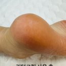 셀투덤 우레아-10 리턴 크림 굳은살 각질 고보습 풋크림 솔직후기