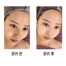 세븐일레븐 이천마도로점 | 이천피부관리 뷰티더연 고보습물광톡스 후기
