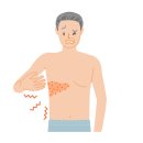 목동더나은내과의원 | 환절기마다 걱정되는 대상포진, 목동 대상포진 주사로 미리 차단하세요!