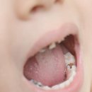 에이스마일치과병원 이미지