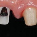 행복치과기공소 이미지