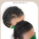 더 채움 스칼프