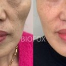 JY 메디칼 이미지