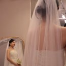 서초한의원 | 예비신부의 튀어나온 큰점 빼기 내돈내산 후기 - 피브로한의원 서초