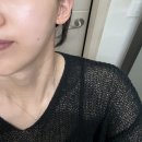 GS25울산복산점 | 울산 중구 피부관리, 모공디톡스 후기 [올가드림뷰티 복산점 ]