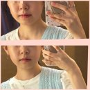 대구 피부관리 미본가 | [대구 피부관리] 대구피부관리미본가 페이스윤곽관리 후기