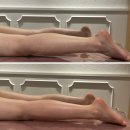 [매곡동 피부관리] 바디슬리밍관리 &lt;미모디에스테틱&gt; 하체 테라노바 후기