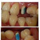 SKY치과기공소 이미지