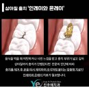 예치과기공소 이미지