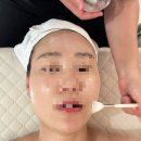 노은힐링의원 | 대전 지족동윤곽관리 마블린에스떼 윤곽 관리 체험후기를 가져왔어용