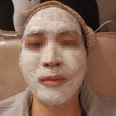 태백에서 못한 인천 여드름압출 잘하는 정은영뷰티크 방문 후기