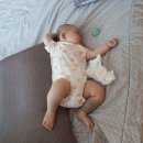 에스앤유현대의원 | 이소성몽고반점 에스앤유 마포공덕 100일아기 치료 및 보험청구