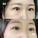 글램속눈썹 청라점 | 청라 노글루 속눈썹펌 잘하는 곳 후기 : 글램속눈썹청라점