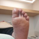 세상편한발톱