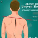 센스짐24 작전동점 | 작전동 헬스장 선생님 목 디스크가 있을 때도 운동 가능한가요...?!